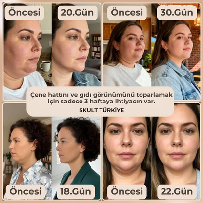 Skult™ Kolajenli Yüz Şekillendirici Band - Gıdı ve Çene Toparlayıcı